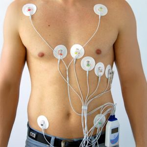 Holter Cardiaco 12 Derivazioni